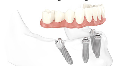 Praxisklinik der Zahnheilkunde am Luisenhospital Aachen