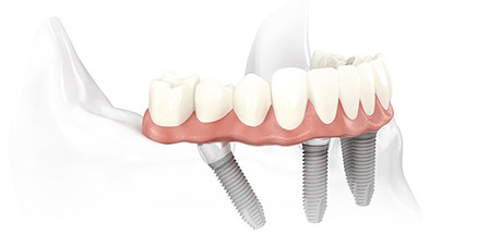 Praxisklinik der Zahnheilkunde am Luisenhospital Aachen